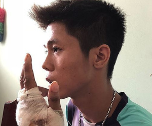 Ảnh minh họa