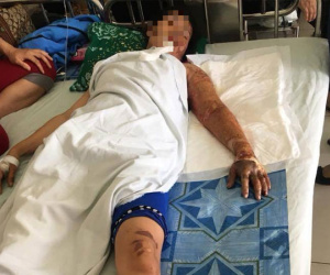 Đồng Tháp: Bị người tình phát hiện có vợ con nên đòi chia tay, gã đàn ông mua xăng về phóng hỏa khiến 3 người nhập viện