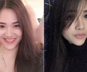 Bị chồng cũ chê răng 'thò thụt mất trật tự', ly hôn xong mẹ trẻ bỏ 40 triệu đi niềng răng, vô tình lột xác đến ngỡ ngàng