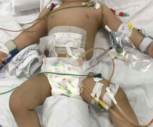 Bé trai 11 tháng tuổi bị mẹ ruột dùng dao đâm nhiều nhát vào bụng nguy kịch