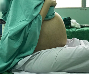 Thường xuyên ăn đêm, cô gái 20 tuổi nghĩ mình béo bụng chủ quan không đi khám suýt chết vì mang u buồng trứng khổng lồ