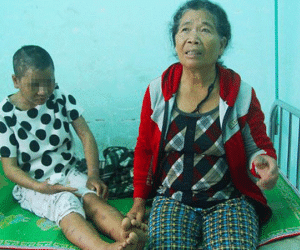 Hành trình tháo chạy khỏi 'địa ngục' của nữ 9X bị tra tấn tàn bạo