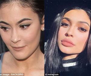 'Nữ hoàng môi tều' Kylie Jenner gây xôn xao vì đôi môi mỏng dính khó nhận ra sau khi rút filler