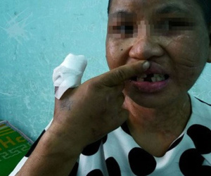Vụ hành hạ dã man người làm công: Cứ 'chơi đá' là ra tay tra tấn