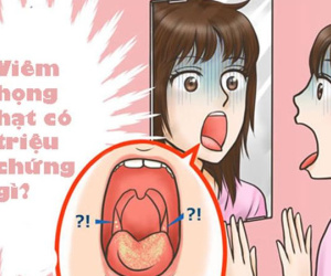 Triệu chứng viêm họng hạt là gì?