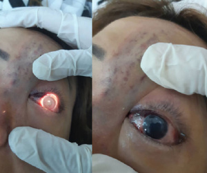 Vụ người phụ nữ ở TP.HCM mù mắt sau khi tiêm filler: Cơ sở thẩm mỹ hoạt động không phép trong chung cư