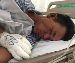 Hé lộ nguyên nhân rể cũ mang xăng đốt nhà và đâm bố vợ bị thương ở Hà Nội