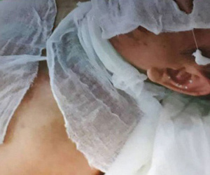 Bắt giữ nghi phạm tạt axit khiến 2 người đàn ông bị bỏng nặng ở Thái Bình