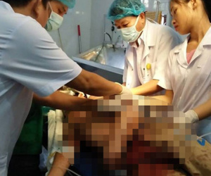 Nghịch súng bắn chết bạn, nam sinh hốt hoảng cứa cổ tự sát