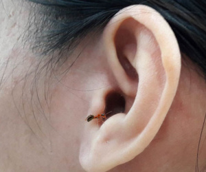 Côn trùng chui vào tai: Tai nạn trời ơi đất hỡi này phải xử lý sao mới đúng?