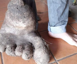 Củ khoai tây khổng lồ giống hệt bàn chân người