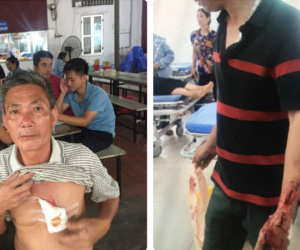 Hà Nội: 5 người cùng nhà bị truy sát phải nhập viện
