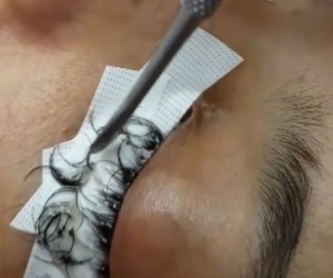 Cô gái đau đớn lĩnh hậu quả với đôi mắt sưng húp, rụng sạch lông mi vì nối mi bằng keo dán sắt