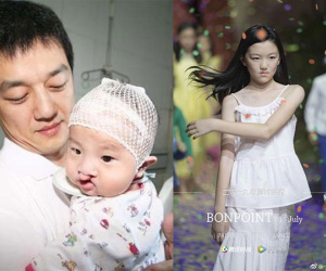 Con gái 13 tuổi khuyết tật của Lý Á Bằng: Cuộc sống nhiều tổn thương và khác người