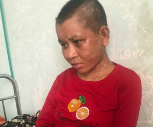 Truy tìm 5 nghi can cùng chủ nhà bạo hành dã man người giúp việc