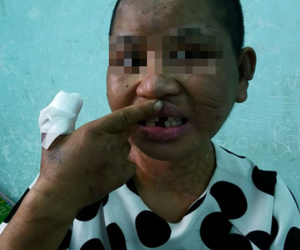 Vụ Nga 'vọc' tra tấn dã man: Yêu cầu thêm 5 người liên quan đến làm việc