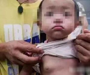 Bé gái 2 tuổi đã phát triển ngực vì bà thường xuyên cho uống loại nước không nên uống