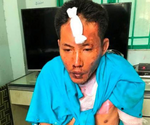Đồng Nai: Bực tức vì bị vợ đuổi ra khỏi nhà, chồng mua xăng về đốt khiến 3 mẹ con nguy kịch