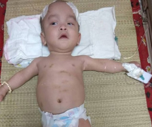 Sinh ra nặng chỉ 1kg, bé trai 14 tháng tuổi đau đớn chống chọi với căn bệnh quái ác