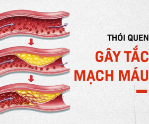 6 thói quen 'phá hủy' mạch máu: Nguyên nhân gây đột quỵ, tử vong mà nhiều người không biết