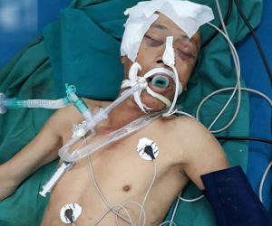 TP.HCM: Người đàn ông chấn thương sọ não vì tai nạn vẫn chưa có người thân vào nhận sau 2 ngày nằm viện