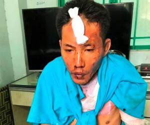 Vụ chồng 'hờ' mua xăng thiêu sống 3 mẹ con: 1 bé gái 12 tuổi đã tử vong