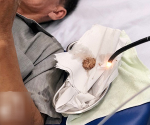 Tưởng ăn thịt heo đã nấu chín không có gì nguy hiểm nhưng vì sai lầm này, người đàn ông suýt mất mạng vì nghẹt thở
