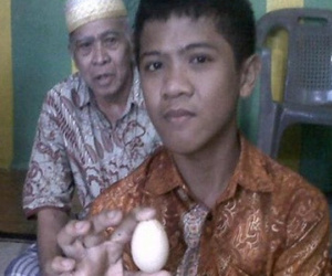 Sự thật bí ẩn gây sốc cậu bé biết đẻ trứng ở Indonesia