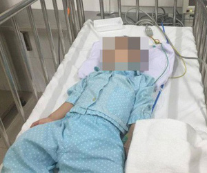 Bé 5 tuổi bị bạn trai của chị họ đánh chấn thương sọ não