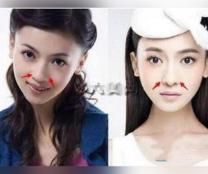 'Ngụy Anh Lạc' Ngô Cẩn Ngôn bị tố độn cằm, gọt mặt V-line, nhan sắc năm xưa khác xa bây giờ