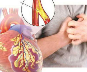 Những bệnh nguy hiểm người ăn nhiều thịt dễ mắc phải, cần điều chỉnh ngay