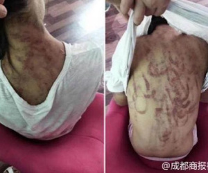 Mẹ kế hành hạ con gái riêng của chồng thân tàn ma dại, cơ thể rớm máu, người bố nhẫn tâm nói 'đánh thế là đúng'