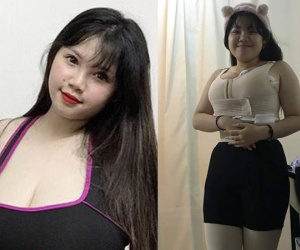 Nữ sinh 'siêu vòng 1' bất ngờ xuất hiện với thân hình eo ót sau khi hút 9 lít mỡ thừa