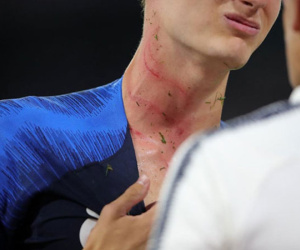 Hậu vệ Chelsea lên tiếng sau pha phạm lỗi làm rách cổ Benjamin Pavard