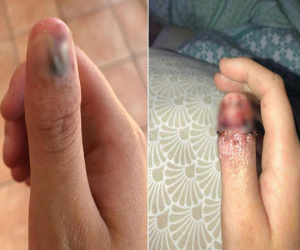 Cô gái 20 tuổi đã bị bệnh ung thư cực nguy hiểm do ngày nào cũng làm việc mà rất nhiều người vẫn làm vì tưởng là vô hại