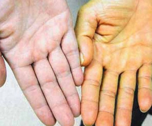 Bác sĩ Bệnh viện K chia sẻ các dấu hiệu 'vàng' cảnh báo bệnh ung thư gan