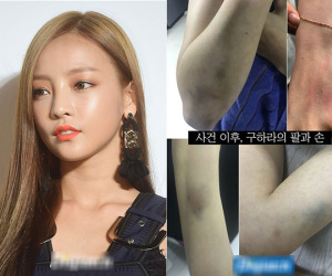 Dispatch bóc mẽ vụ hành hung chấn động: Goo Hara bị chảy máu tử cung, bầm tím nghiêm trọng vì bạn trai đánh