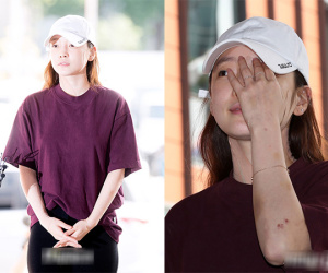 Goo Hara lần đầu lộ diện sau vụ hành hung: Mặt sưng vù, cổ và tay đầy vết bầm máu và băng bó nghiêm trọng