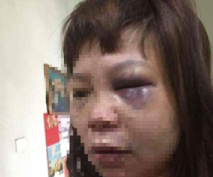 Chồng 'dụ' vợ lên đồi đánh đập dã man ở Quảng Ninh: Bắt tạm giam người chồng để điều tra