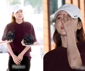'Nữ thần' Goo Hara lộ mặt biến dạng, người đầy vết thương sau scandal bạo hành