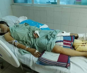 Vụ tai nạn giao thông khiến 13 người tử vong tại Lai Châu: Thoát cửa tử nhưng đối mặt với tận cùng nỗi đau