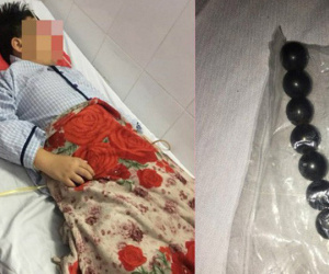 Vụ đứa trẻ bị bạn ép nuốt 9 viên bi nam châm: Hãy dạy trẻ cách yêu bản thân