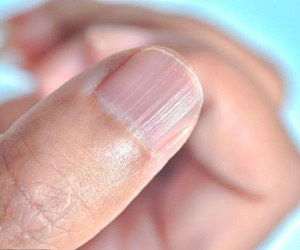 Tưởng là dấu hiệu bình thường của cơ thể, hóa ra lại là bệnh rất nguy hiểm