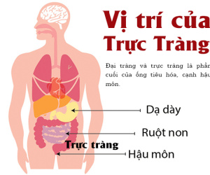5 dấu hiệu điển hình cảnh báo khối u ung thư đại trực tràng đang phát triển 'thần tốc'