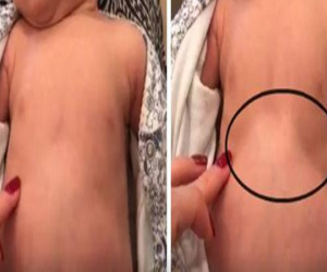 Thấy con thở với dấu hiệu lạ trên ngực, mẹ mau chóng quay lại video giúp cứu sống con