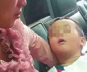 Một bé tổn thương não, 2 bé tử vong vì hành động trêu chọc sai lầm của người lớn
