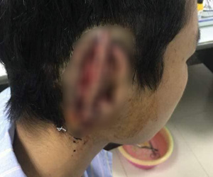 Nam sinh cắn đứt rồi nuốt tai của bạn vào bụng âm tính với ma túy?