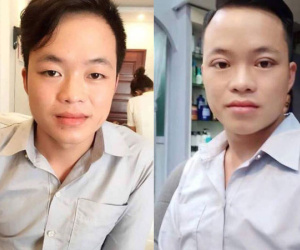 Cô dâu 62 tuổi đưa chồng 26 đi nhấn mí để đẹp trai hơn
