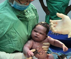 Em bé 'gây bão' vì chào đời không thèm khóc, chưng ngay vẻ mặt: 'Sao lại lôi cháu ra đây!'
