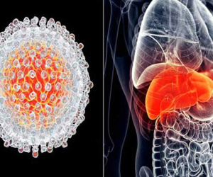 Có 7 triệu chứng này kéo dài 2 tuần: Hãy đi khám ung thư gan để giữ cơ hội sống cao nhất